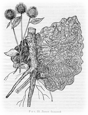 Лопух большой (лопух репейник) при ревматизме и подагре